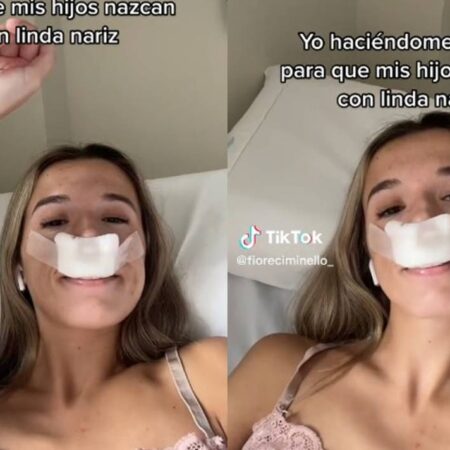 Joven afirma que se hizo la rinoplastia para que sus hijos nazcan con nariz linda y desata burlas [Video] – El Sol de Puebla